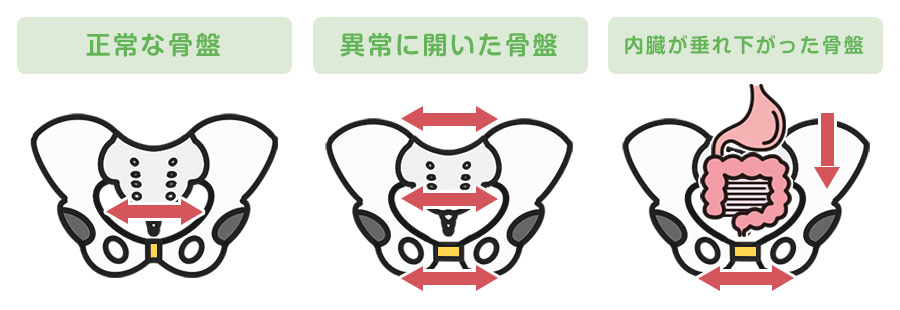 産後の骨盤